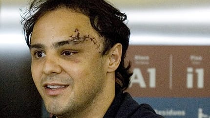 Felipe Massa Narbe Unfall 2009 Felipe Massa